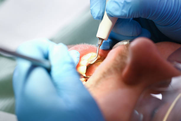 Best Emergency Dental Care for Sports Injuries in Norwalk, IA